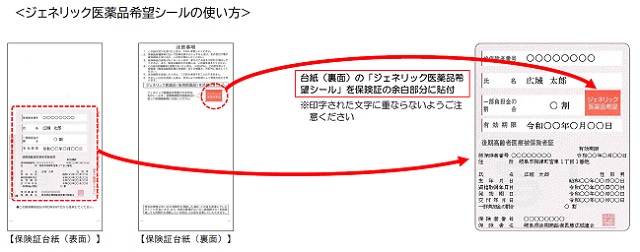 ジェネリック希望シールの使い方